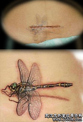 疤痕美化纹身蜻蜓纹身